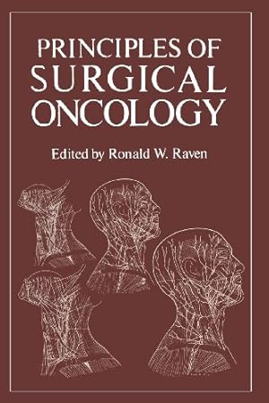 Seller image for Principles of Surgical Oncology by Raven, Ronald [Paperback ] for sale by booksXpress