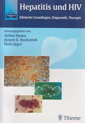 Image du vendeur pour Hepatitis und HIV : klinische Grundlagen, Diagnostik, Therapie ; 31 Tabellen. hrsg. von Stefan Mauss . Mit Beitr. von C. E. Broelsch . / HIV-Medizin - standards of care mis en vente par Allguer Online Antiquariat