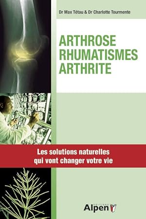 Arthrose-rhumathimes-arthrite