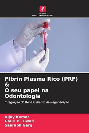 Bild des Verkufers fr FIbrin Plasma Rico (PRF) & O seu papel na Odontologia zum Verkauf von moluna