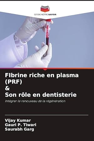 Bild des Verkufers fr FIbrine riche en plasma (PRF) & Son rle en dentisterie zum Verkauf von moluna