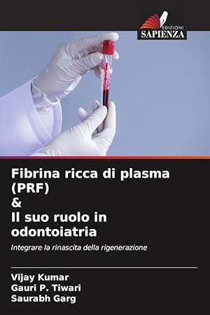 Bild des Verkufers fr Fibrina ricca di plasma (PRF) & Il suo ruolo in odontoiatria zum Verkauf von moluna