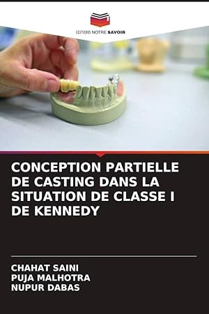Bild des Verkufers fr CONCEPTION PARTIELLE DE CASTING DANS LA SITUATION DE CLASSE I DE KENNEDY zum Verkauf von moluna