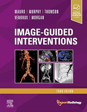 Seller image for Image-Guided Interventions: Expert Radiology Series by Mauro MD FACR, Matthew A., Murphy MB FRCPC FSIR, Kieran P.J., Thomson MD FRANZCR, Kenneth R., Venbrux MD, Anthony C., Morgan MBChB MRCP FRCR EBIR, Robert A. [Hardcover ] for sale by booksXpress