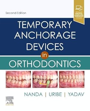 Imagen del vendedor de Temporary Anchorage Devices in Orthodontics [Hardcover ] a la venta por booksXpress