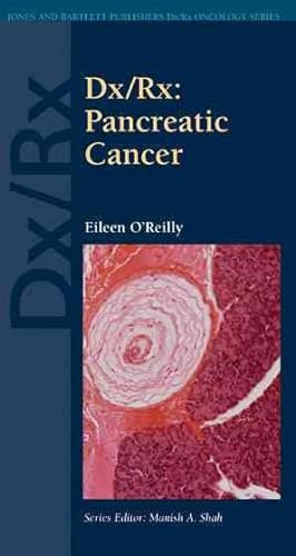 Immagine del venditore per Dx/Rx : Pancreatic Cancer venduto da GreatBookPrices