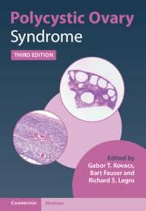 Image du vendeur pour Polycystic Ovary Syndrome mis en vente par AHA-BUCH GmbH