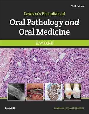 Seller image for CAWSONS ESSENTIALS OF ORAL PATHOLOGY & O for sale by moluna