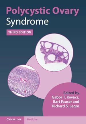 Seller image for Polycystic Ovary Syndrome for sale by GreatBookPrices