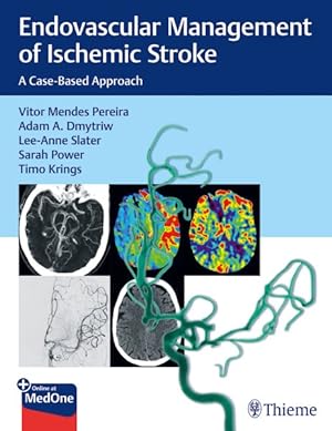 Bild des Verkufers fr Endovascular Management of Ischemic Stroke : A Case-Based Approach zum Verkauf von GreatBookPrices