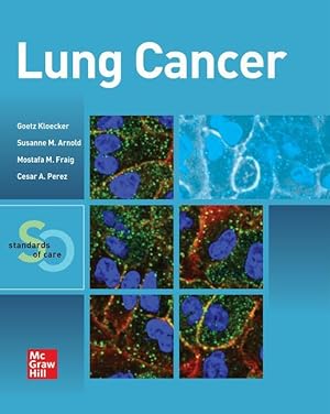 Bild des Verkufers fr Lung Cancer: Standards of Care zum Verkauf von moluna