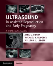 Imagen del vendedor de Ultrasound in Assisted Reproduction and Early Pregnancy a la venta por moluna