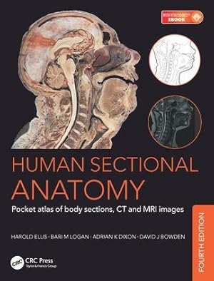 Image du vendeur pour Human Sectional Anatomy: Pocket Atlas of Body Sections, CT and MRI Images mis en vente par moluna