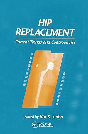 Image du vendeur pour Sinha, R: Hip Replacement mis en vente par moluna