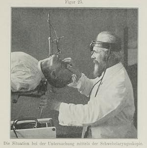 Bild des Verkufers fr Die Schwebelaryngoskopie (pp.277-317, 30 Abb., 1 farblith. Taf.). zum Verkauf von Antiq. F.-D. Shn - Medicusbooks.Com