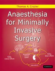 Seller image for Anaesthesia for Minimally Invasive Surgery for sale by moluna