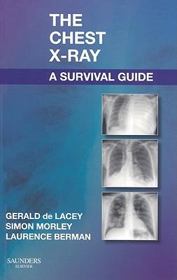 Bild des Verkufers fr The Chest X-Ray: A Survival Guide zum Verkauf von moluna