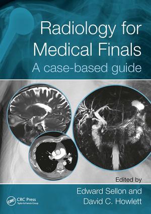 Seller image for Radiology for Medical Finals for sale by moluna