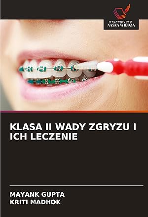 Seller image for Klasa II Wady Zgryzu I Ich Leczenie for sale by moluna