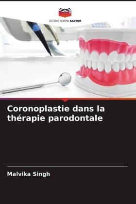Bild des Verkufers fr Coronoplastie dans la thrapie parodontale zum Verkauf von moluna