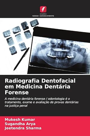 Bild des Verkufers fr Radiografia Dentofacial em Medicina Dentria Forense zum Verkauf von moluna