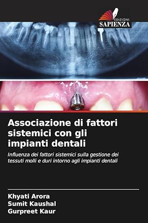 Bild des Verkufers fr Associazione di fattori sistemici con gli impianti dentali zum Verkauf von moluna