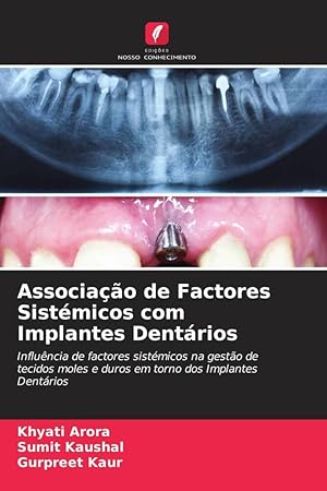 Bild des Verkufers fr Associao de Factores Sistmicos com Implantes Dentrios zum Verkauf von moluna