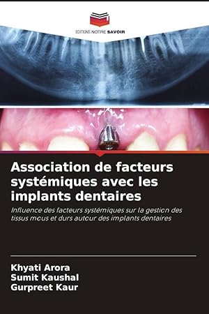 Bild des Verkufers fr Association de facteurs systmiques avec les implants dentaires zum Verkauf von moluna