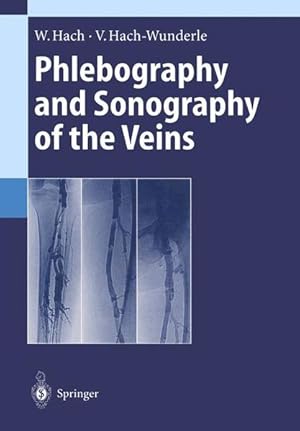 Phlebography and Sonography of the Veins.