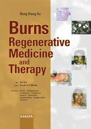 Bild des Verkufers fr Burns Regenerative Medicine and Therapy. zum Verkauf von Antiquariat Thomas Haker GmbH & Co. KG