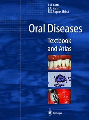 Bild des Verkufers fr Oral Diseases. Textbook and Atlas. zum Verkauf von Antiquariat Thomas Haker GmbH & Co. KG