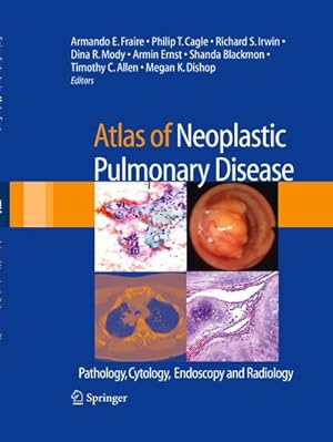 Imagen del vendedor de Atlas of Neoplastic Pulmonary Disease : Pathology, Cytology, Endoscopy and Radiology a la venta por AHA-BUCH GmbH