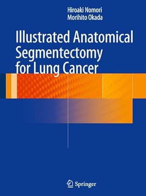 Seller image for Illustrated Anatomical Segmentectomy for Lung Cancer for sale by AHA-BUCH GmbH