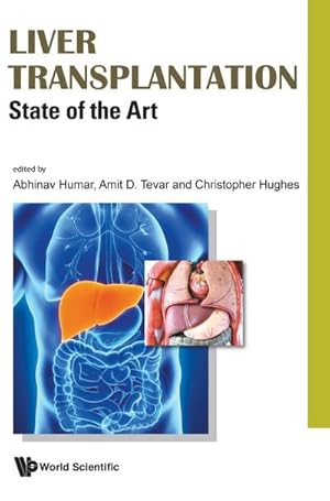 Imagen del vendedor de Liver Transplantation : State of the Art a la venta por AHA-BUCH GmbH