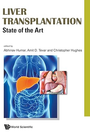 Imagen del vendedor de Liver Transplantation: State Of The Art a la venta por moluna