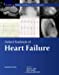 Seller image for Oxford Textbook of Heart Failure (Oxford Textbooks in Cardiology) [Hardcover ] for sale by booksXpress
