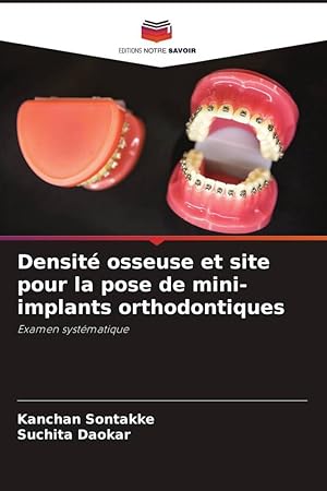 Bild des Verkufers fr Densit osseuse et site pour la pose de mini-implants orthodontiques zum Verkauf von moluna