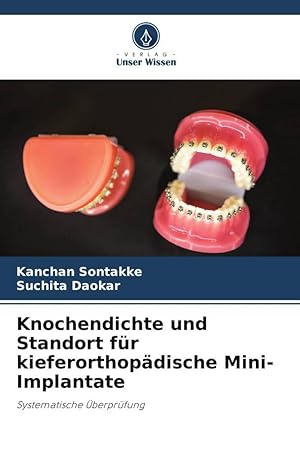 Bild des Verkufers fr Densidad sea y sitio para la colocacin de mini-implantes de ortodoncia zum Verkauf von moluna