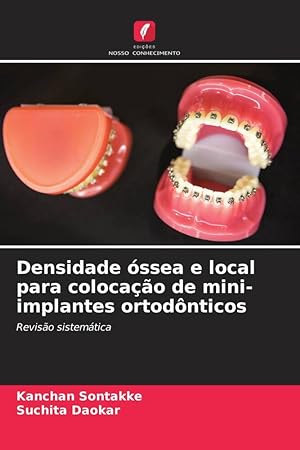 Bild des Verkufers fr Densidade ssea e local para colocao de mini-implantes ortodnticos zum Verkauf von moluna