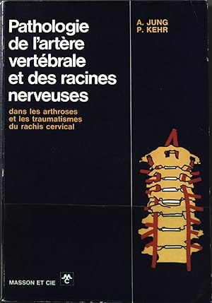 Imagen del vendedor de Pathologie de l'artre vertbrale et des racines nerveuses dans les arthroses et les traumatismes du rachis cervical a la venta por books4less (Versandantiquariat Petra Gros GmbH & Co. KG)