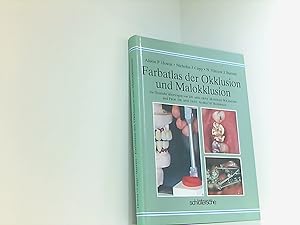 Farbatlas der Okklusion und Malokklusion