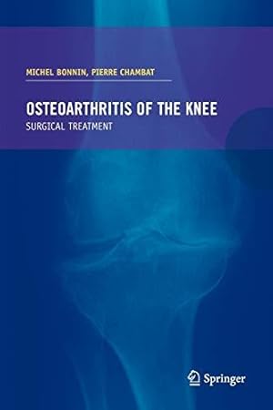 Bild des Verkufers fr Osteoarthritis of the knee zum Verkauf von WeBuyBooks