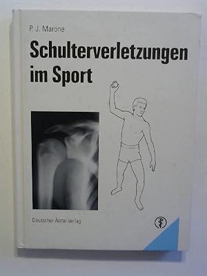 Schulterverletzungen im Sport.