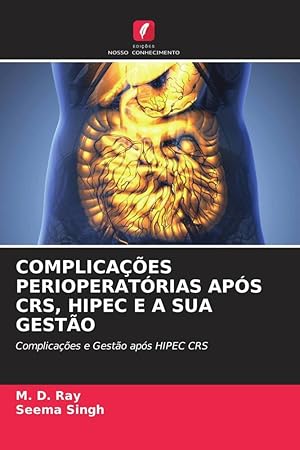 Bild des Verkufers fr COMPLICAES PERIOPERATRIAS APS CRS, HIPEC E A SUA GESTO zum Verkauf von moluna