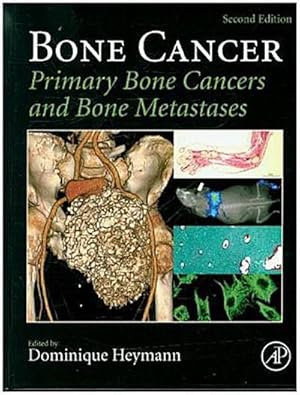 Seller image for Bone Cancer : Primary Bone Cancers and Bone Metastases for sale by AHA-BUCH GmbH