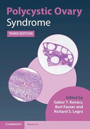 Image du vendeur pour Polycystic Ovary Syndrome (Hardcover) mis en vente par AussieBookSeller
