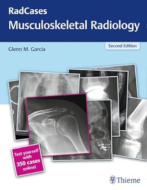 Immagine del venditore per Radcases Musculoskeletal Radiology venduto da Wegmann1855