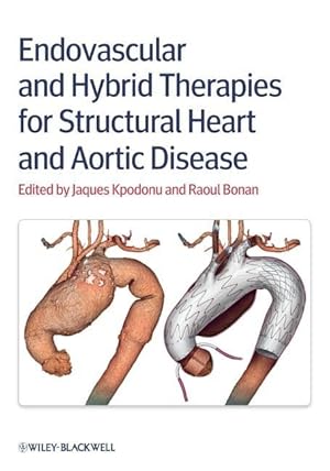 Bild des Verkufers fr Endovascular and Hybrid Therapies for Structural Heart and Aortic Disease zum Verkauf von moluna