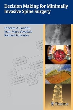 Image du vendeur pour Decision Making for Minimally Invasive Spine Surgery mis en vente par moluna