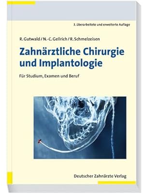 Seller image for Zahnrztliche Chirurgie und Implantologie for sale by Wegmann1855